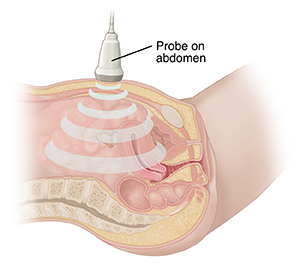 Cross section of female pelvis viewed from side. Ultrasound transducer placed on lower abdomen.