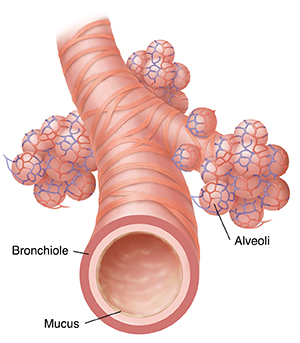 Closeup view of bronchiole and alveoli.