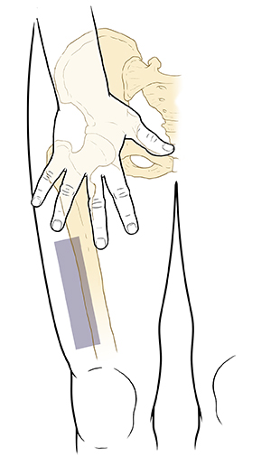 Hand with fingers spread and palm down on front of thigh. Shaded rectangle below hand shows best injection area.