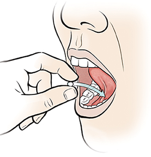 Close-up of mouth showing fingers placing pill under tongue.